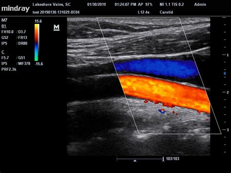 vascular vs nonvascular ultrasound.